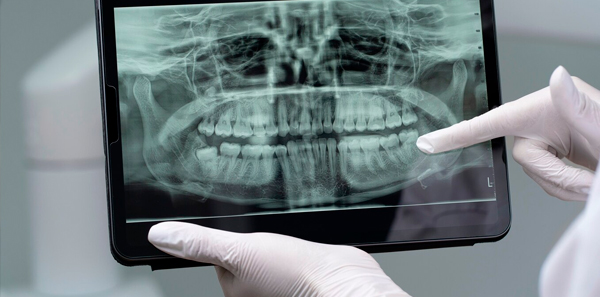 img-endodontia