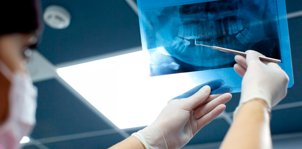 img-implantes