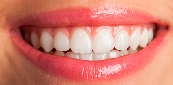 img-periodontia